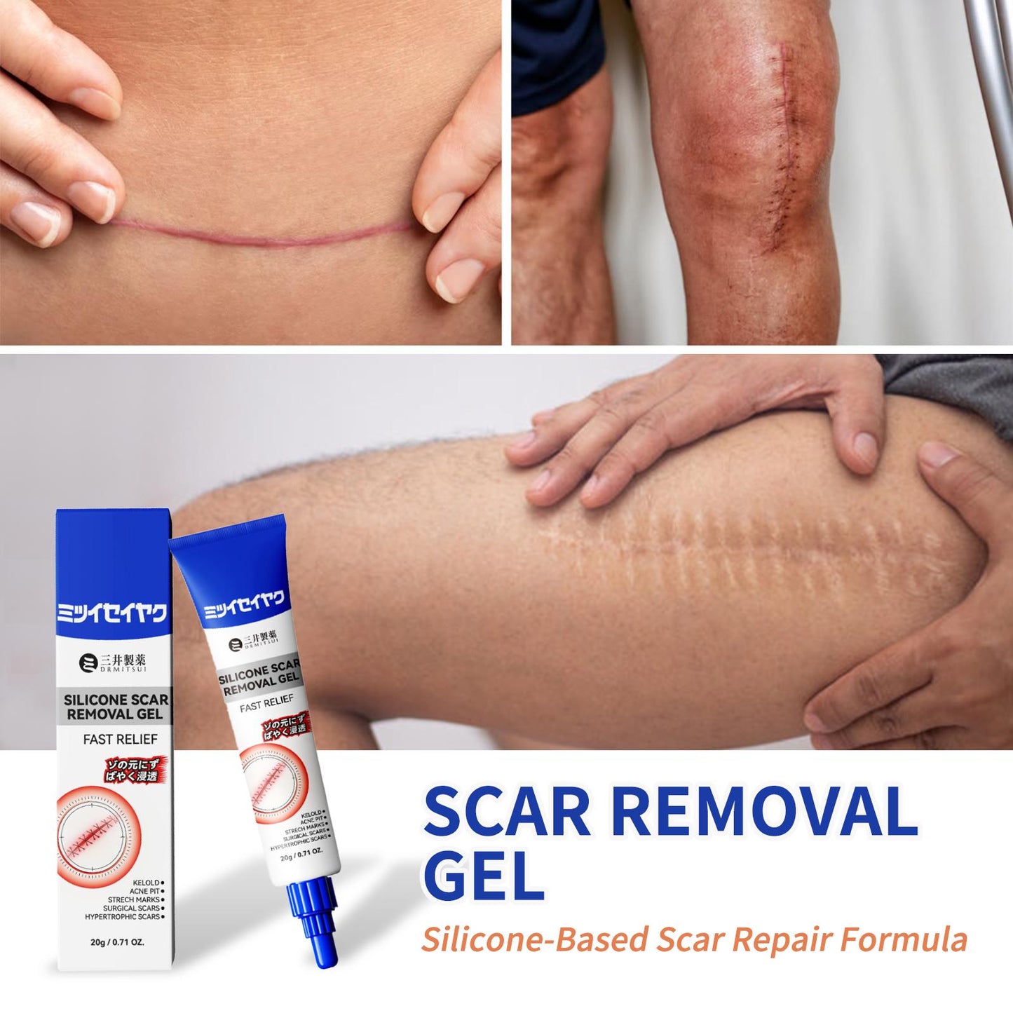 DRMITSUI Silicone Scar Gel for Old and New Scars