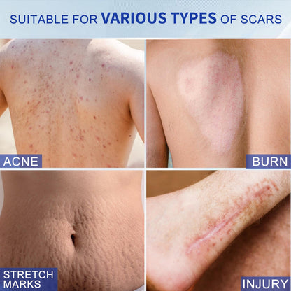 DRMITSUI Silicone Scar Gel for Old and New Scars