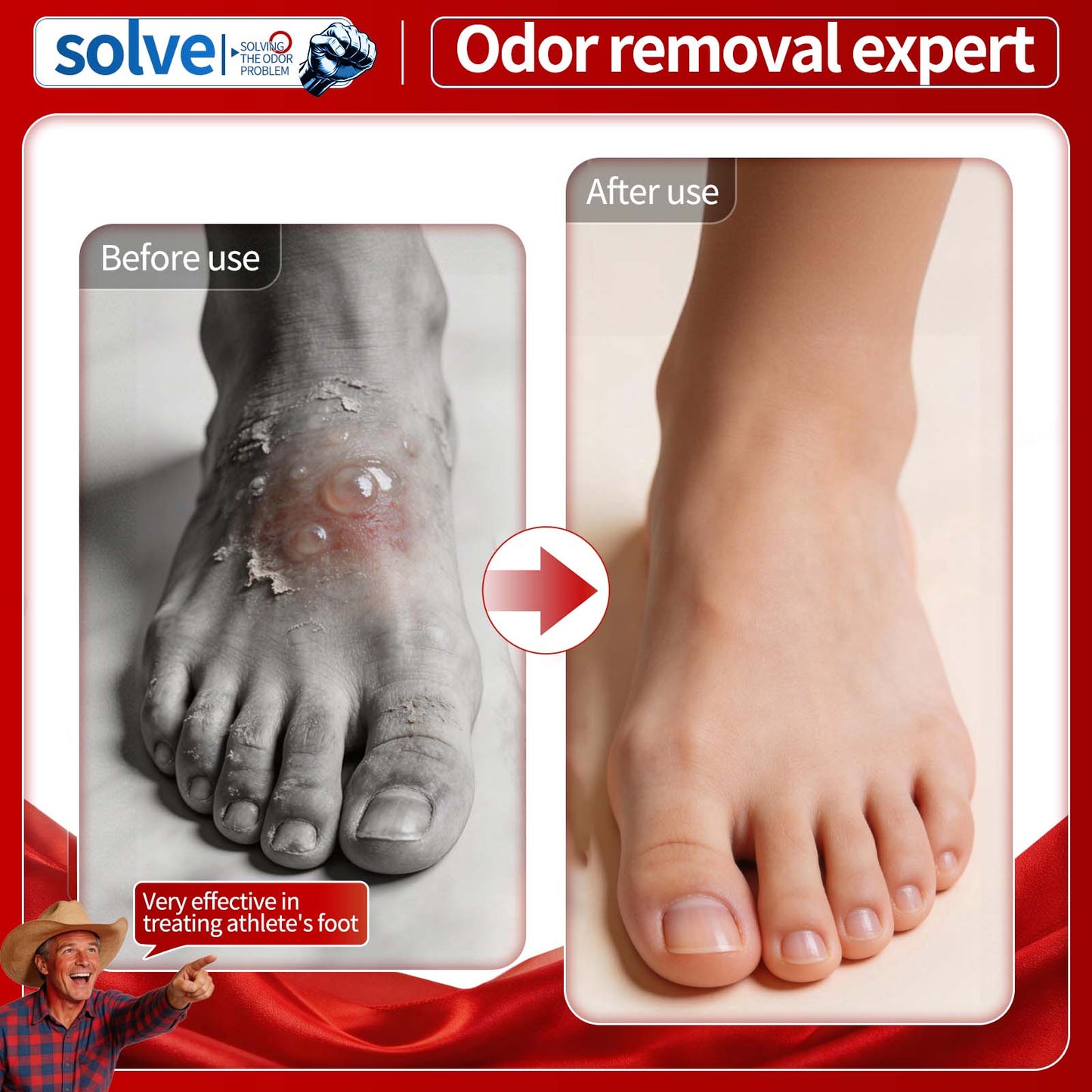 Solve Foot Care Spray for Odor & Dry Skin