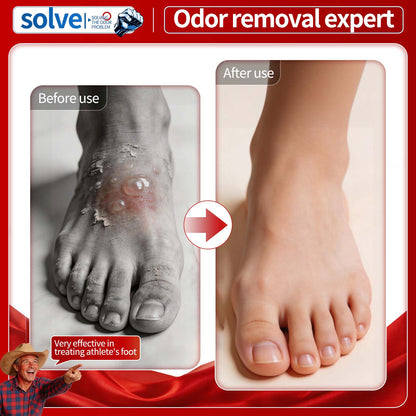 Solve Foot Care Spray for Odor & Dry Skin