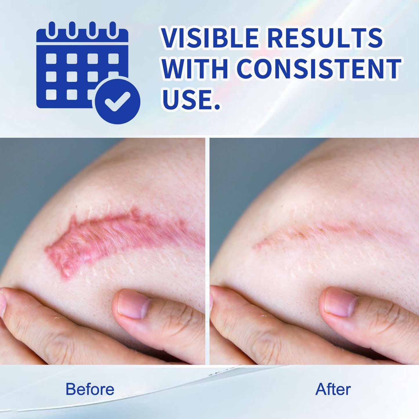 DRMITSUI Silicone Scar Gel for Old and New Scars